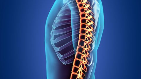 Degenerative Disc Disease Treatment At Our Orlando Pain Clinic