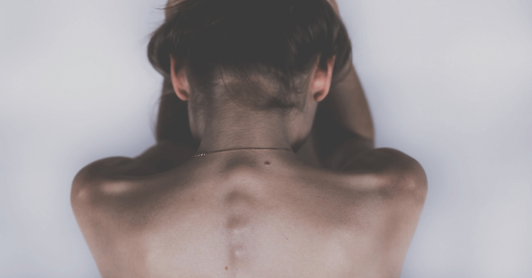 PRP for herniated disc at Orlando