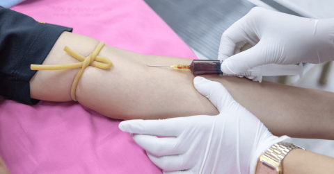 What Injuries Can PRP Treat?
